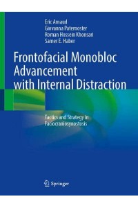 Frontofacial Monobloc Advancement With Internal Distraction Tactics and Strategy in Faciocraniosynostosis