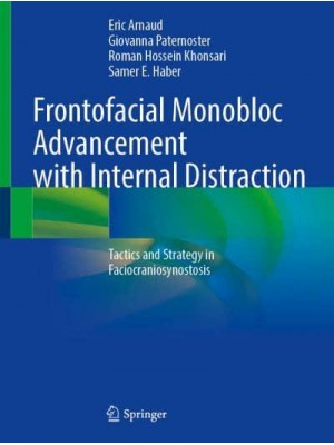 Frontofacial Monobloc Advancement With Internal Distraction Tactics and Strategy in Faciocraniosynostosis