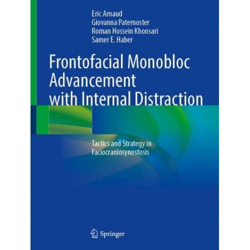 Frontofacial Monobloc Advancement With Internal Distraction Tactics and Strategy in Faciocraniosynostosis