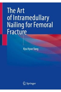 The Art of Intramedullary Nailing for Femoral Fracture