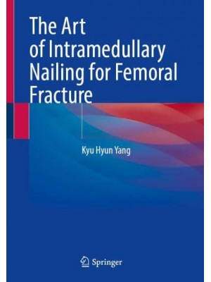 The Art of Intramedullary Nailing for Femoral Fracture
