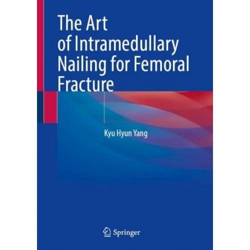 The Art of Intramedullary Nailing for Femoral Fracture
