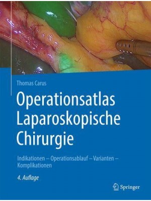 Operationsatlas Laparoskopische Chirurgie Indikationen - Operationsablauf - Varianten - Komplikationen