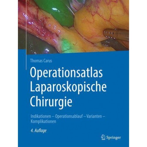 Operationsatlas Laparoskopische Chirurgie Indikationen - Operationsablauf - Varianten - Komplikationen