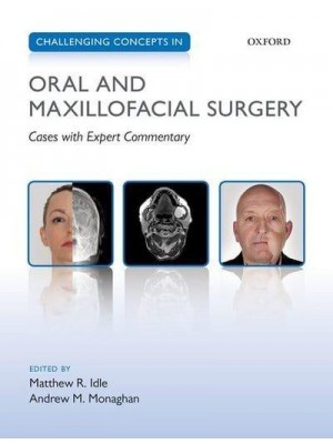 Challenging Concepts in Oral and Maxillofacial Surgery Cases With Expert Commentary - Challenging Cases