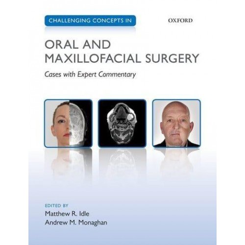 Challenging Concepts in Oral and Maxillofacial Surgery Cases With Expert Commentary - Challenging Cases