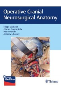 Operative Cranial Neurosurgical Anatomy