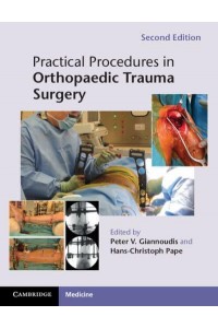 Practical Procedures in Orthopaedic Trauma Surgery