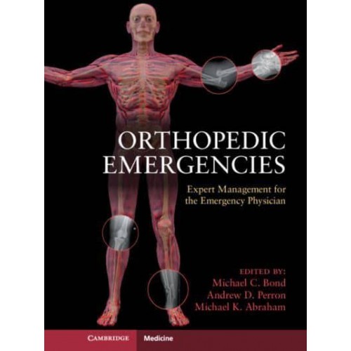 Orthopedic Emergencies Expert Management for the Emergency Physician