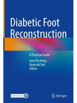 Diabetic Foot Reconstruction A Practical Guide