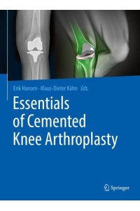 Essentials of Cemented Knee Arthroplasty