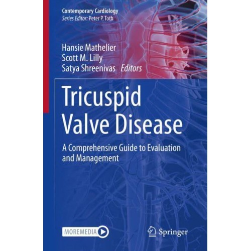 Tricuspid Valve Disease A Comprehensive Guide to Evaluation and Management - Contemporary Cardiology