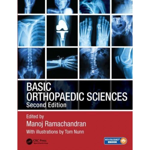 Basic Orthopaedic Sciences