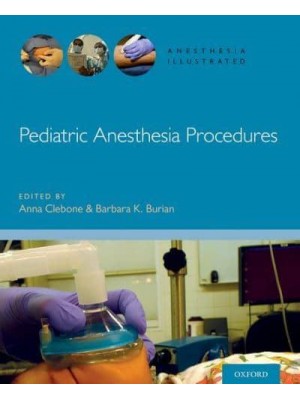 Pediatric Anesthesia Procedures - Anesthesia Illustrated
