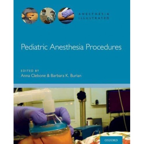 Pediatric Anesthesia Procedures - Anesthesia Illustrated