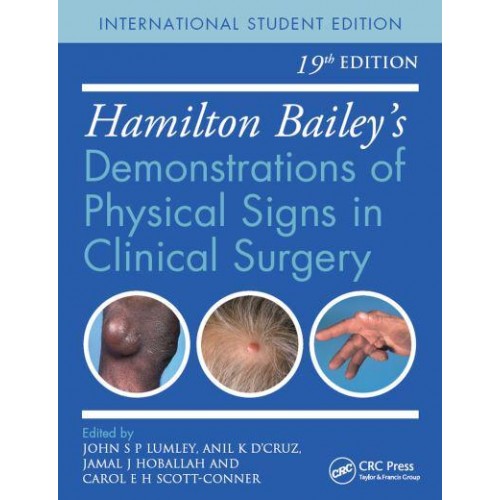Hamilton Bailey's Physical Signs