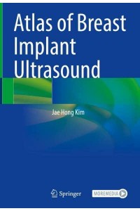 Atlas of Breast Implant Ultrasound