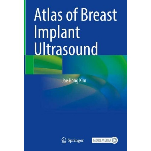 Atlas of Breast Implant Ultrasound