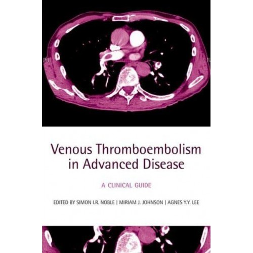 Venous Thromboembolism in Advanced Disease: A Clinical Guide