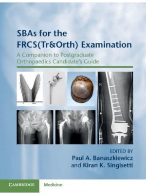 SBAs for the FRCS (Tr & Orth) Examination A Companion to Postgraduate Orthopaedics Candidate's Guide