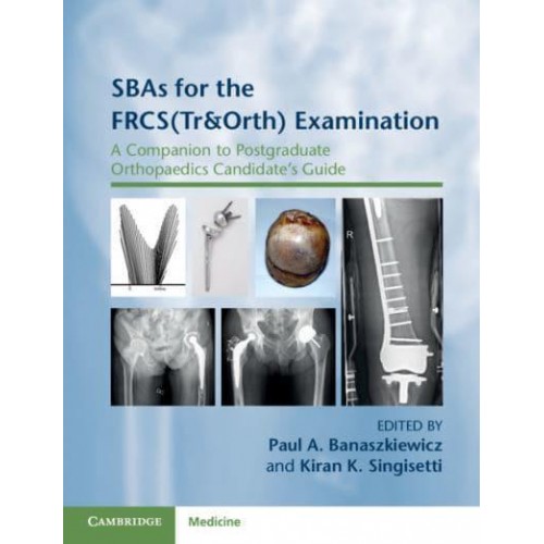 SBAs for the FRCS (Tr & Orth) Examination A Companion to Postgraduate Orthopaedics Candidate's Guide