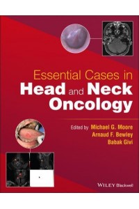 Essential Cases in Head and Neck Oncology