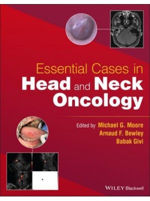 Essential Cases in Head and Neck Oncology