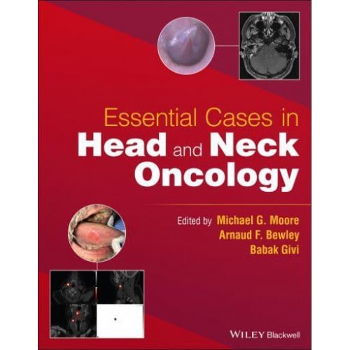 Essential Cases in Head and Neck Oncology