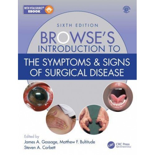 Browse's Introduction to the Symptoms & Signs of Surgical Disease