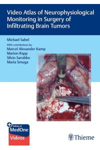 Video Atlas of Neurophysiological Monitoring in Surgery of Infiltrating Brain Tumors