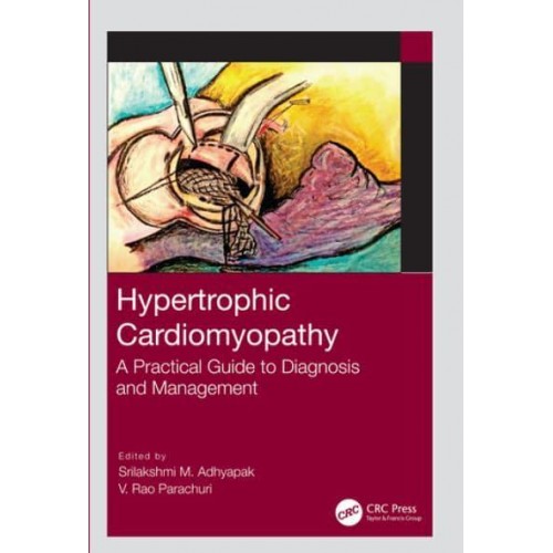 Hypertrophic Cardiomyopathy A Practical Guide to Diagnosis and Management