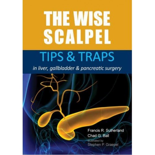 The Wise Scalpel Tips & Traps in Liver, Gallbladder & Pancreatic Surgery