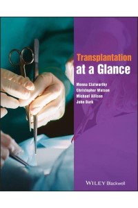 Transplantation at a Glance - At a Glance