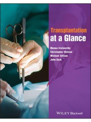 Transplantation at a Glance - At a Glance