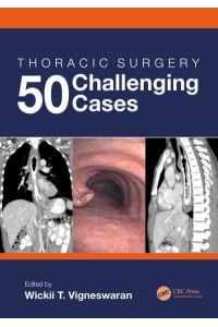 Thoracic Surgery 50 Challenging Cases