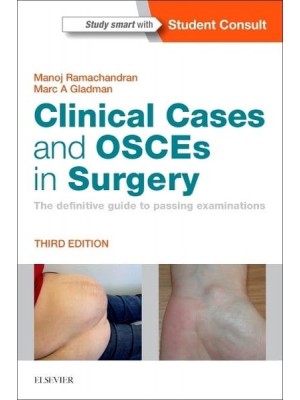 Clinical Cases and OSCEs in Surgery The Definitive Guide to Passing Examinations