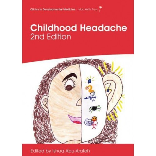 Childhood Headache - Clinics in Developmental Medicine (Unnumbered)