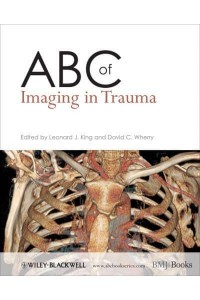 ABC of Imaging in Trauma - ABC Series