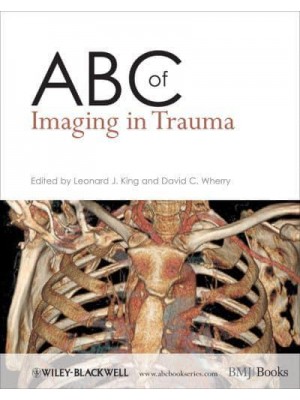 ABC of Imaging in Trauma - ABC Series