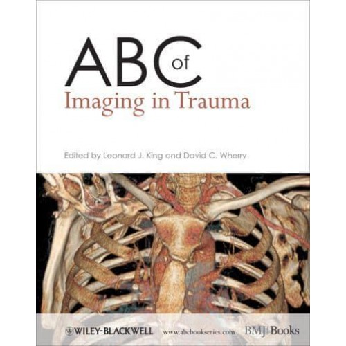 ABC of Imaging in Trauma - ABC Series