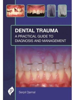 Dental Trauma A Practical Guide to Diagnosis and Management