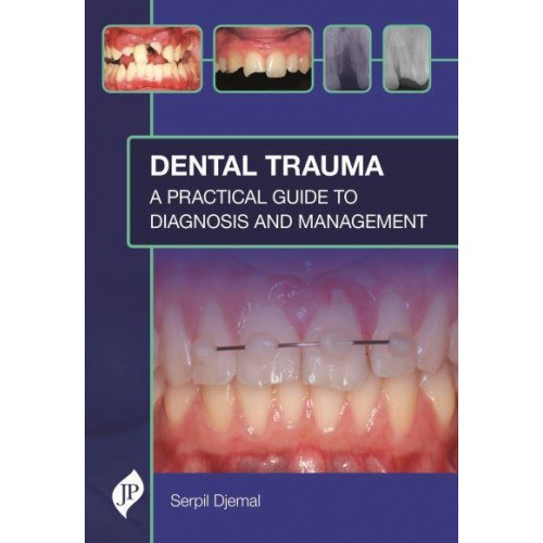 Dental Trauma A Practical Guide to Diagnosis and Management