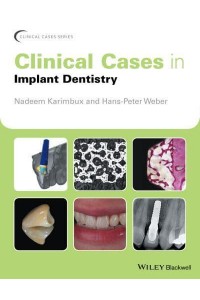 Clinical Cases in Implant Dentistry - Clinical Cases (Dentistry)
