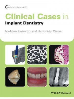 Clinical Cases in Implant Dentistry - Clinical Cases (Dentistry)