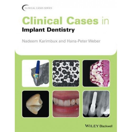 Clinical Cases in Implant Dentistry - Clinical Cases (Dentistry)