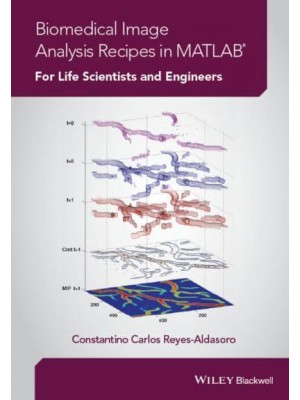 Biomedical Image Analysis Recipes in MATLAB¬ For Life Scientists and Engineers