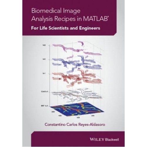 Biomedical Image Analysis Recipes in MATLAB¬ For Life Scientists and Engineers