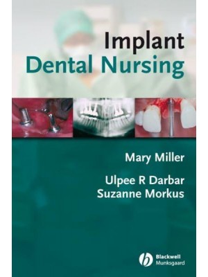 Implant Dental Nursing