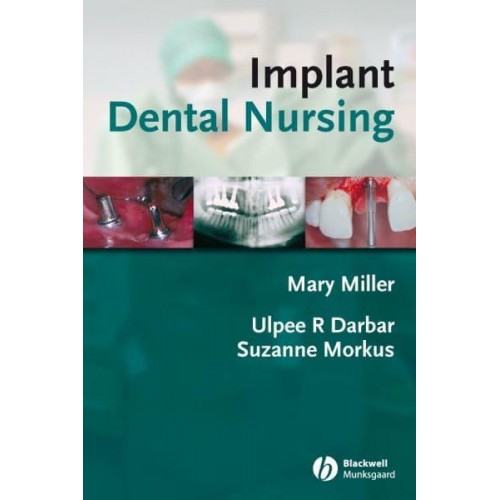 Implant Dental Nursing