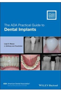 The ADA Practical Guide to Dental Implants - ADA Practical Guide